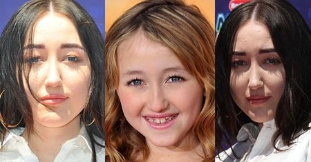 17-letnia siostra Miley Cyrus nadal majstruje przy twarzy... (FOTO)