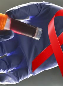 HIV rozprzestrzenia się w Polsce. Niepokojąca liczba zakażeń