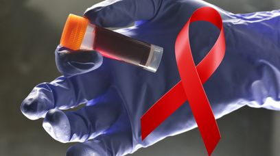 HIV rozprzestrzenia się w Polsce. Niepokojąca liczba zakażeń