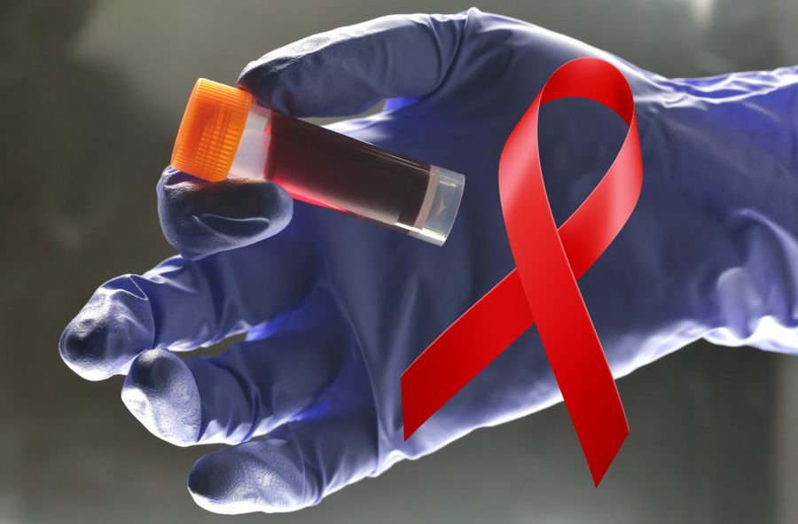 Lekarz trzymający fiolkę z krwią w celu zbadania pod kątem obecności HIV