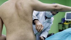 Objawy są podobne. Ta choroba "udaje" raka jelita grubego