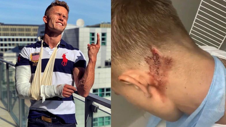 Łukasz z "Hotel Island" został napadnięty przez innego uczestnika?