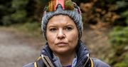 "Nie taki diabeł straszny". Manowska pokazała twarz dzień po zabiegu