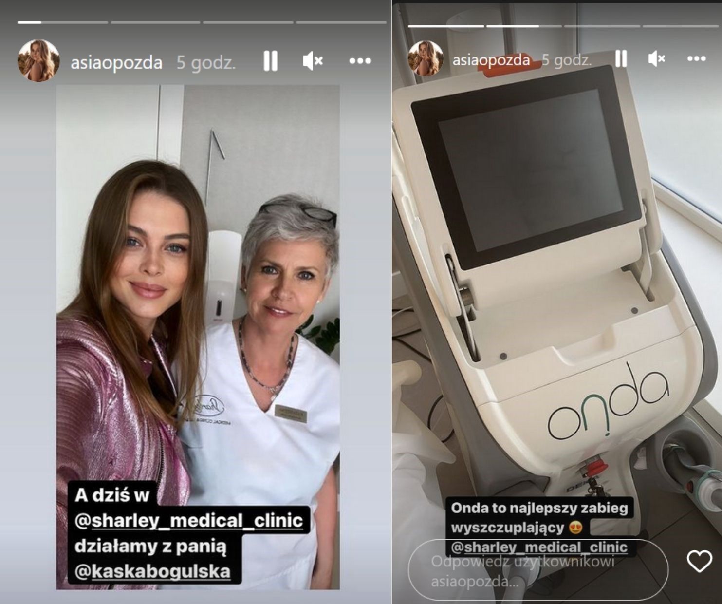 Zabieg odchudzający Joanny Opozdy