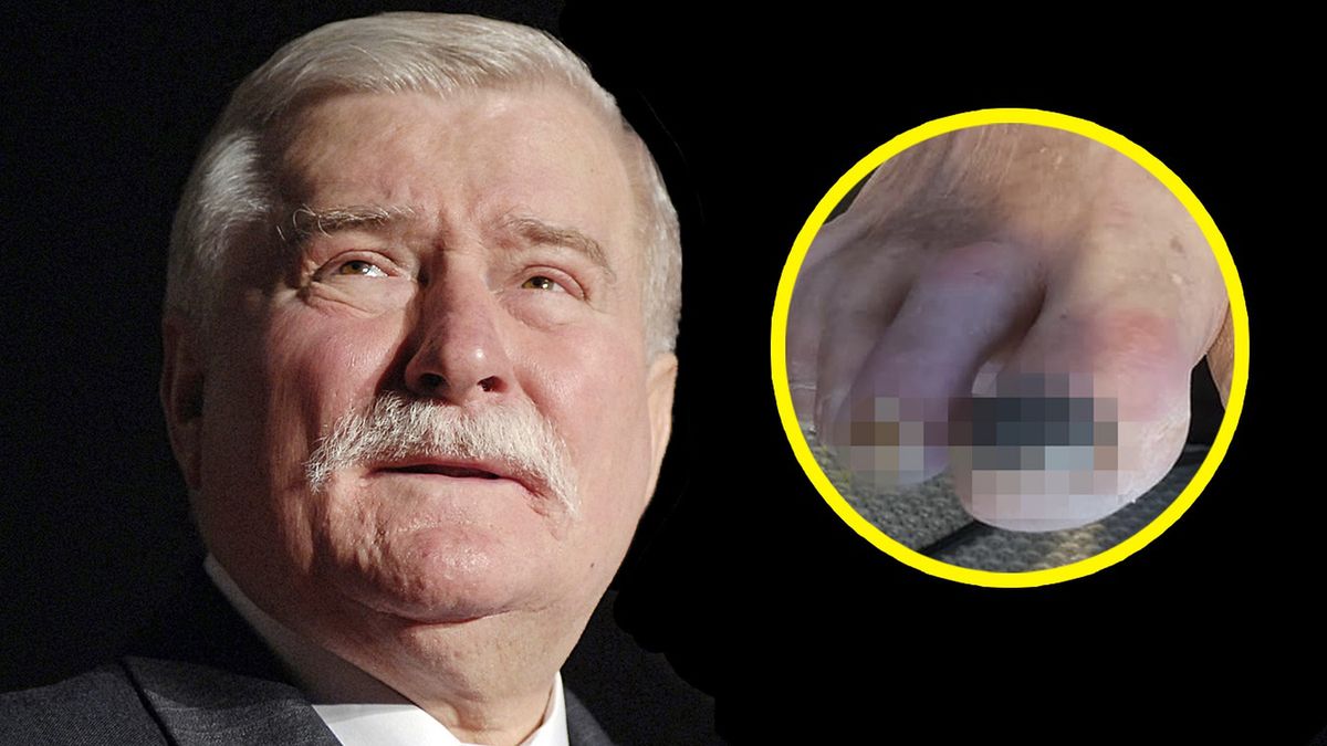 Lech Wałęsa pokazał zdjęcie swoich stóp
