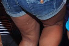 Anna Mucha ma cellulit!