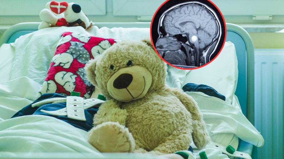 Mówili, że to tylko migrena