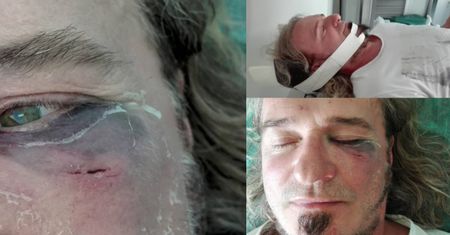 Wokalista Oddziału Zamkniętego BRUTALNIE POBITY! "Trzech na jednego, od tyłu, bez ostrzeżenia"