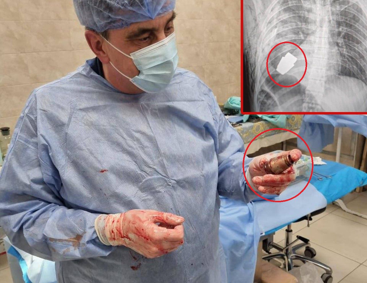 Snajperzy na sali operacyjnej. Lekarze usuwali niewybuch z ciała żołnierza