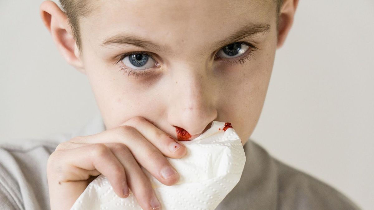 Krwotok z nosa może mieć różne przyczyny