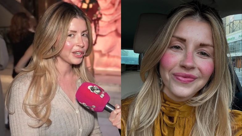 Ciocia Liestyle o operacji powiek i kolejnych poprawkach