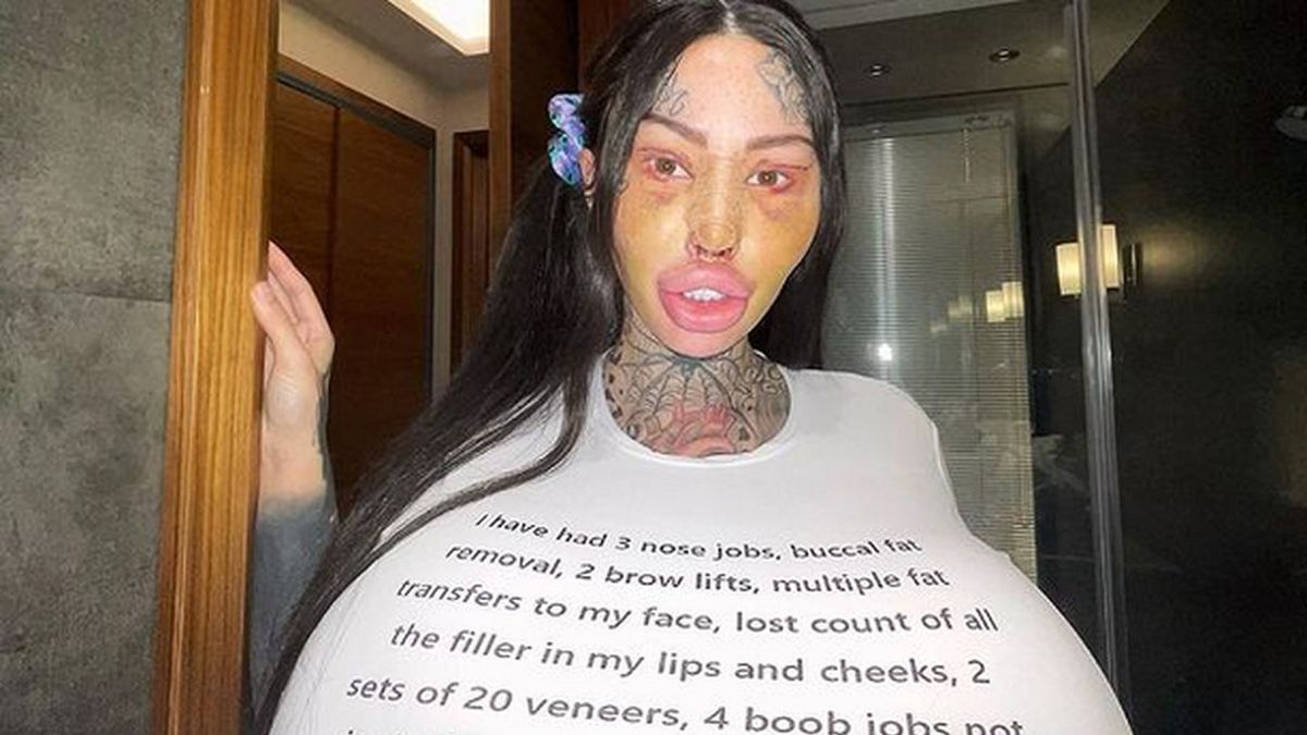 Ma "nos jak Barbie" i "kocie oczy" 