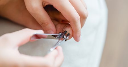 Wycinasz skórki? Lepiej pozbądź się tego nawyku