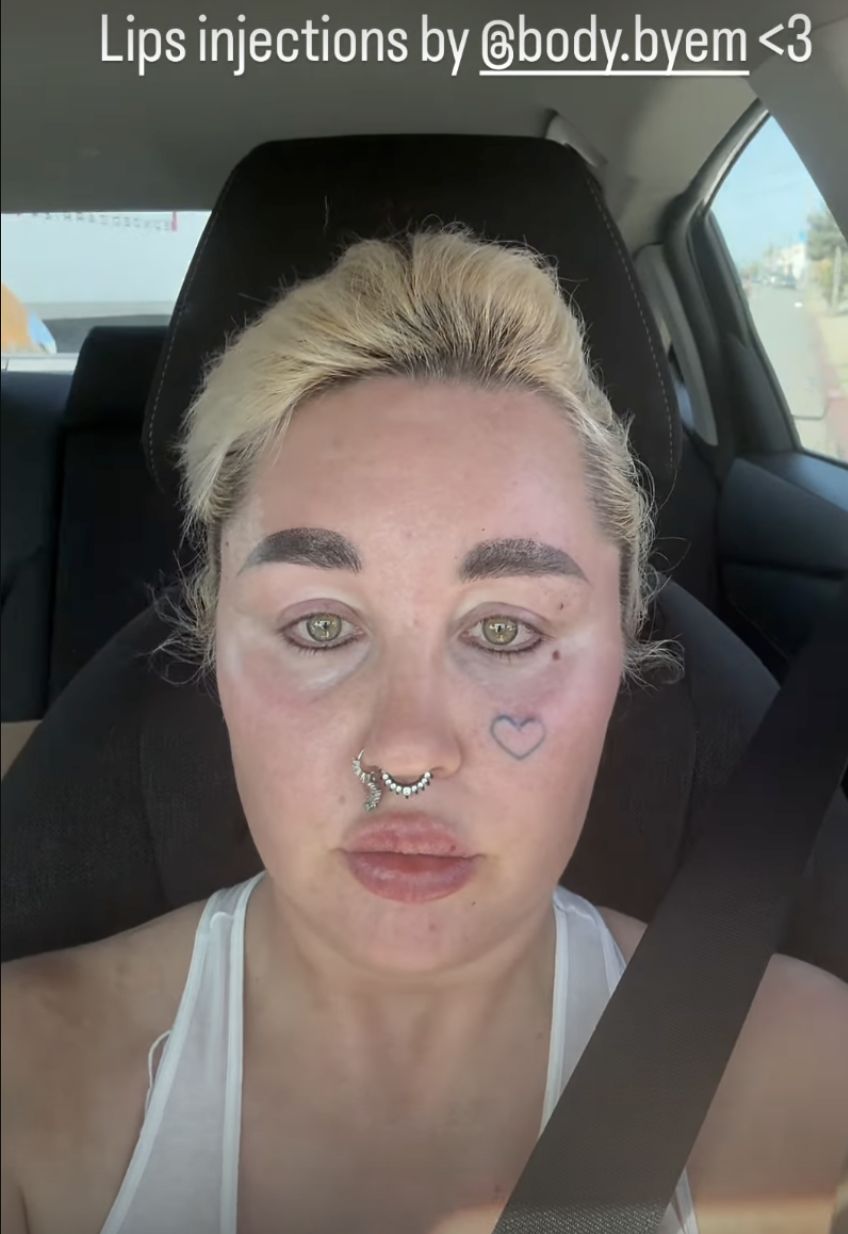 Amanda Bynes powiększyła usta