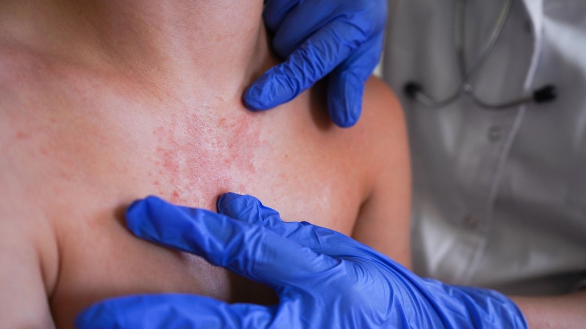 Eksperci apelują o czujność