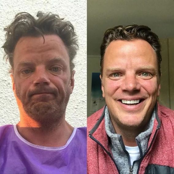 Jakość życia po odstawieniu alkoholu zdecydowanie się poprawia 