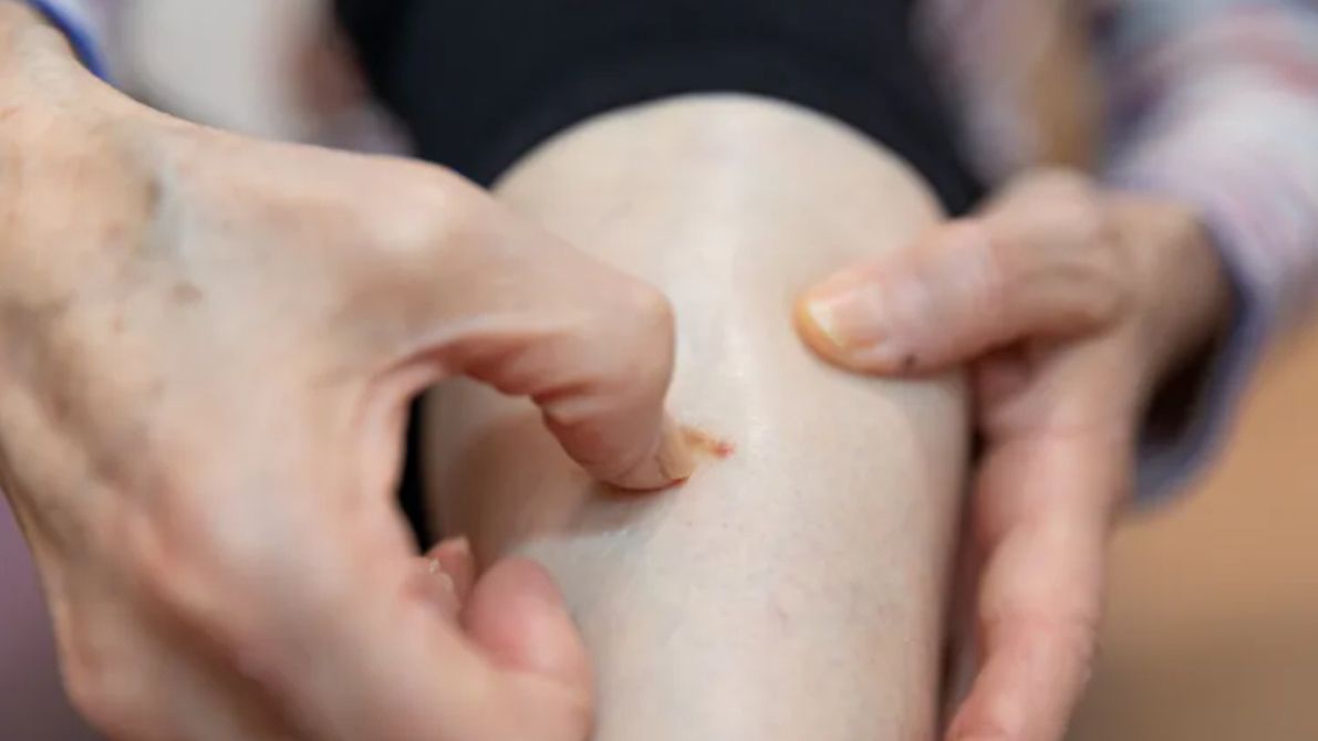 8 objawów raka, które mogą uratować ci życie. Musisz o tym wiedzieć