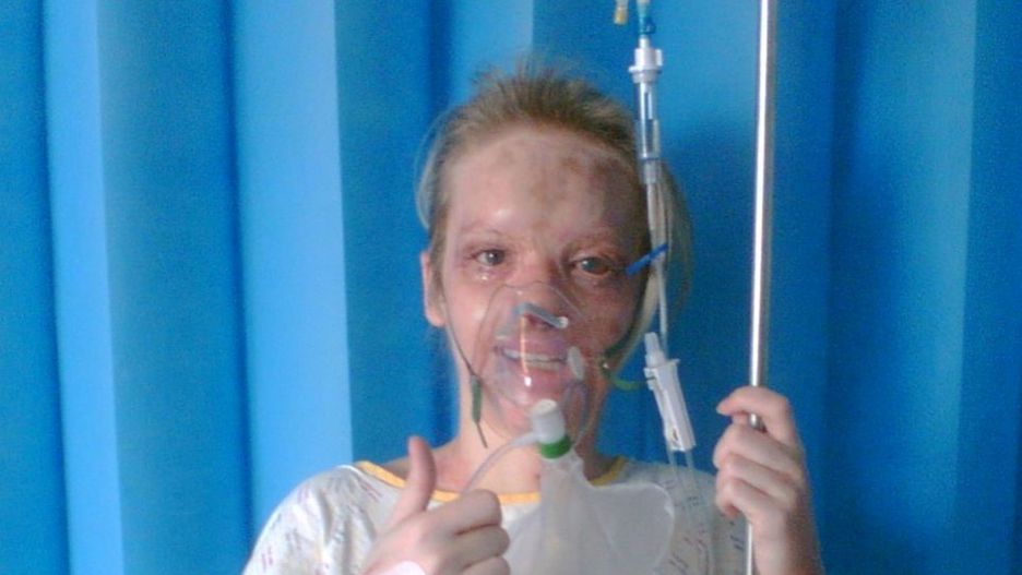 Katie Piper ma za sobą traumatyczne przejścia
