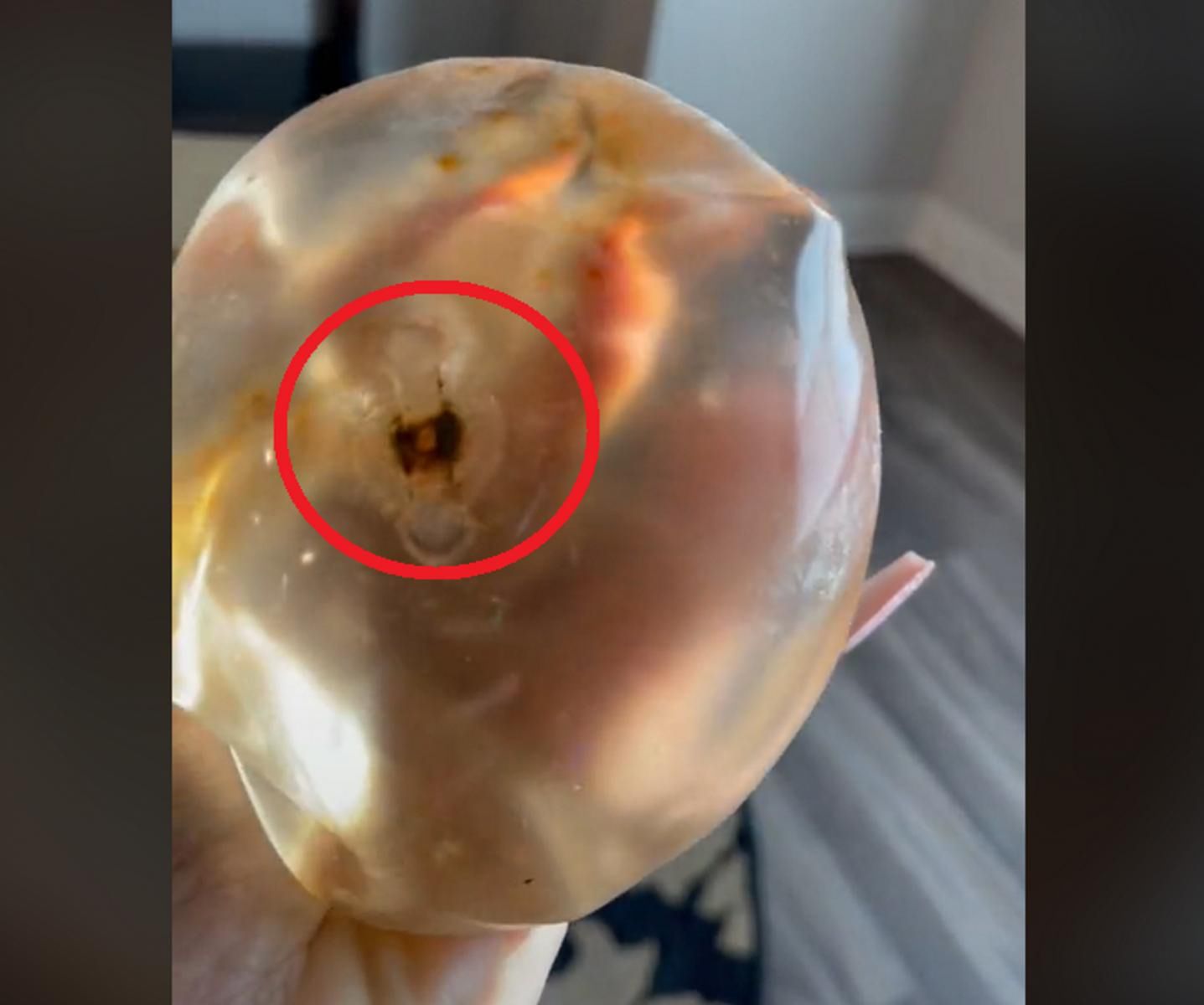 Influencerka pokazała jak wyglądają jej implanty piersi po usunięciu