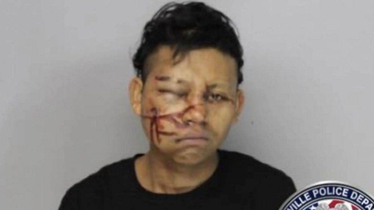 Policja pokazała zdjęcie przestępcy