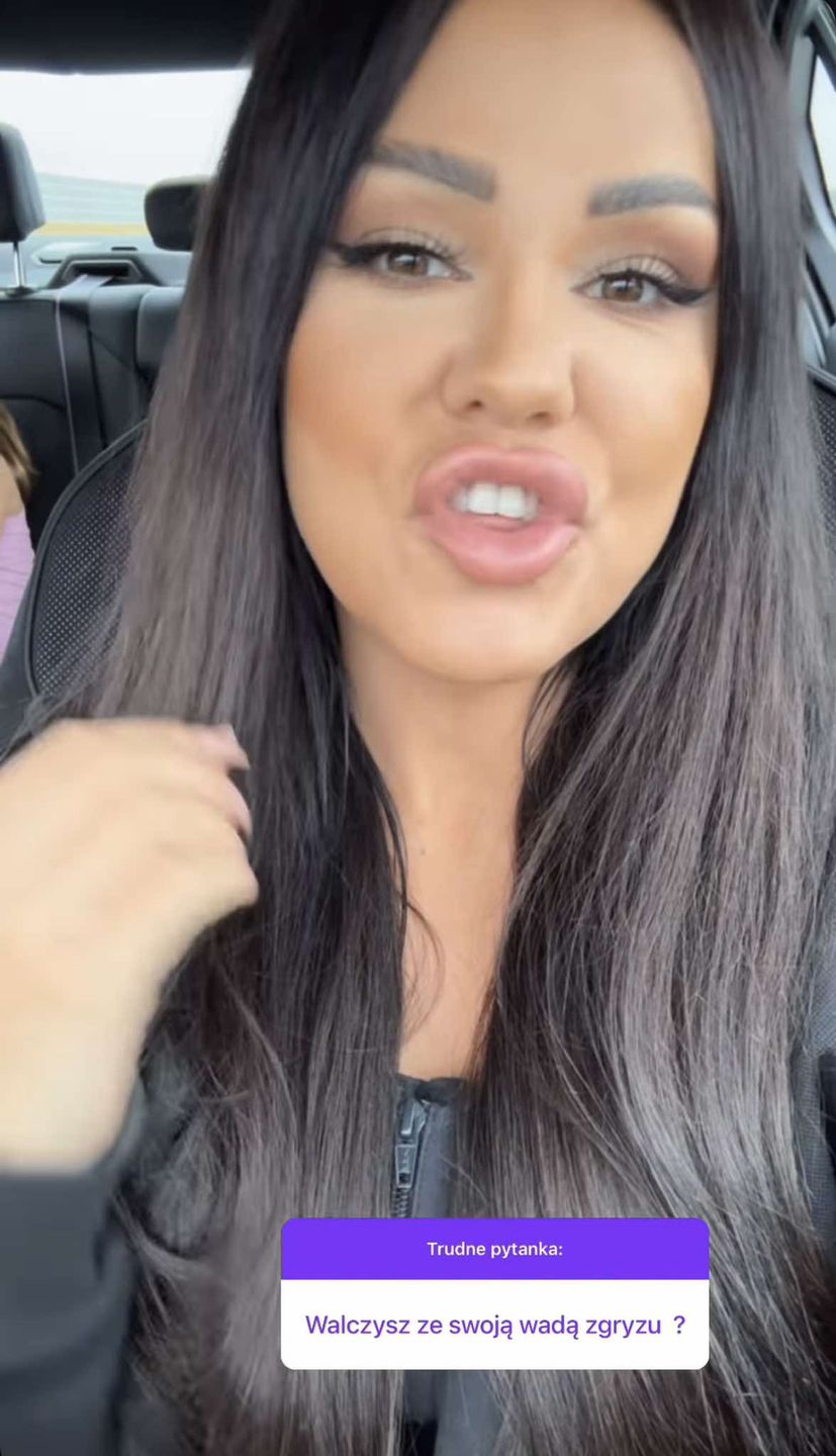 Sylwia Bomba tłumaczy fance, czemu nie walczy z wadą zgryzu