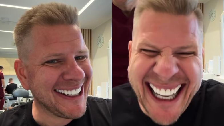 Filip Chajzer też ma nowe zęby! Internauci w szoku