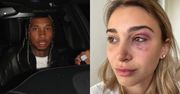 Tyga POBIŁ DZIEWCZYNĘ? Raper został aresztowany przez policję!