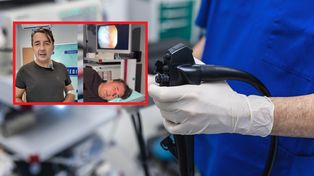 Prof. Murawa poddał się kolonoskopii na wizji. Oto co wykazało badanie