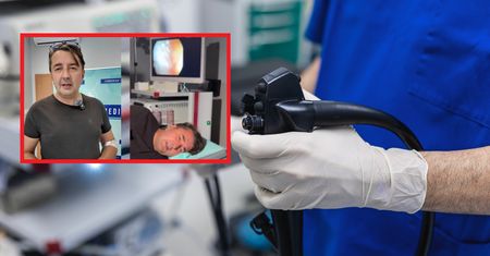 Prof. Murawa poddał się kolonoskopii na wizji. Oto co wykazało badanie