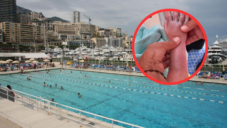 Chłopiec uwięziony w hotelowym basenie na Majorce. Interweniowały służby ratunkowe