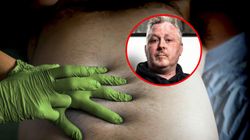 Dziennikarz zmaga się z rakiem jelit. Objawy atakowały w samochodzie i w toalecie