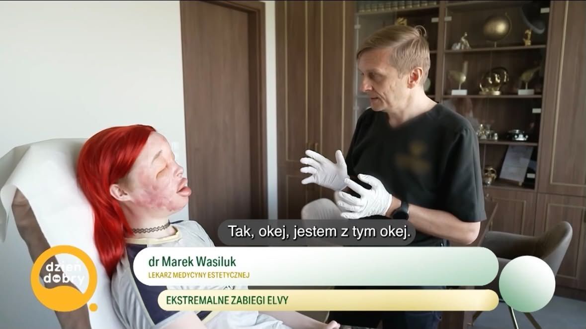 26-letnia Elva zdeformowała sobie twarz