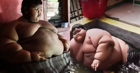 Ważył 190 kg. Dziesięciolatek zmienił się nie do poznania