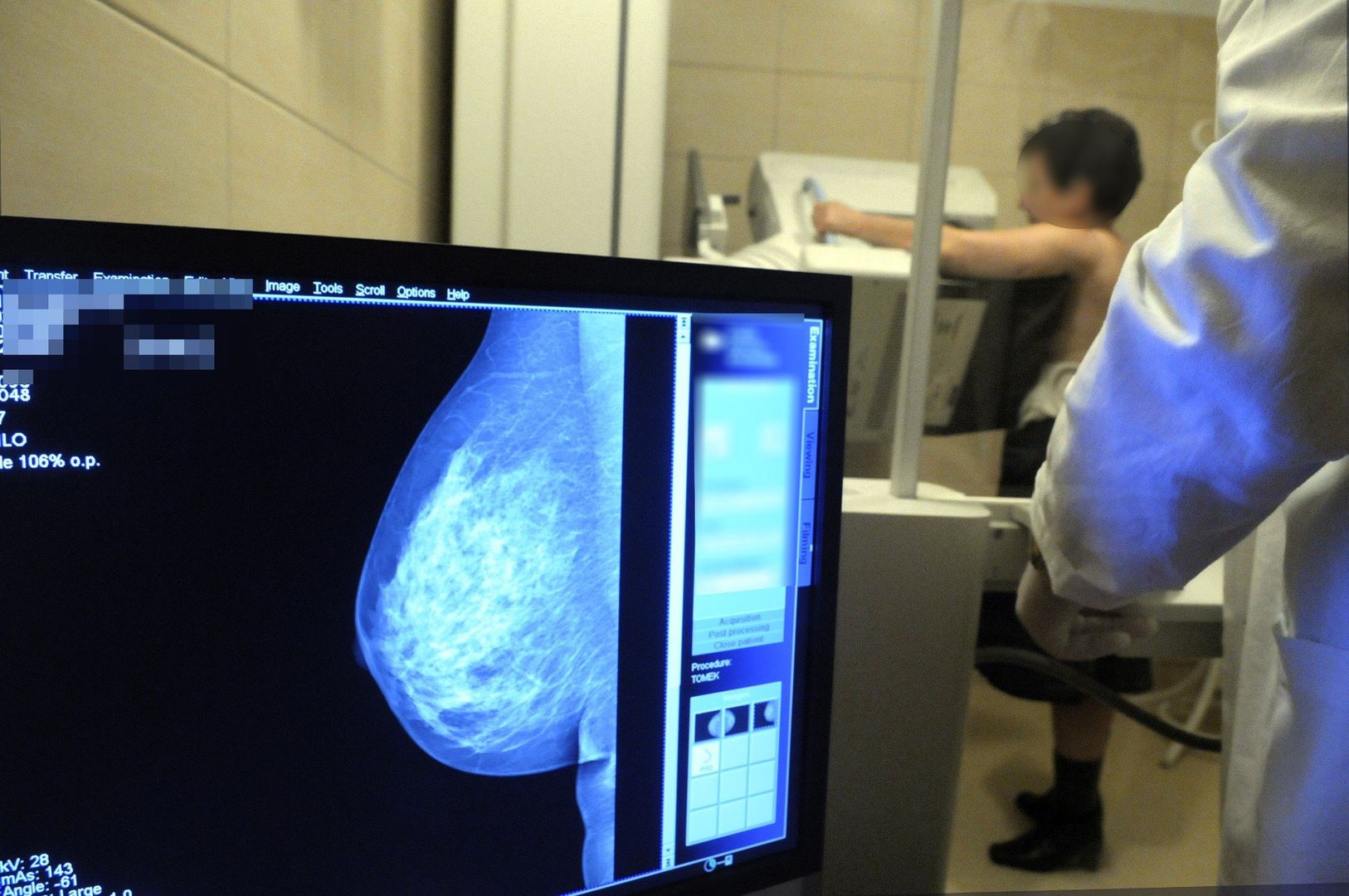Najwięcej uprawnionych kobiet, bo aż 53 proc., skorzystało z możliwości wykonania darmowej mammografii w gminie Mietków. Tuż za Mietkowem uplasowały się Sobótka, Jordanów Śląski, Długołęka, Czernica i Żórawina z wynikami na poziomie 44–48 proc.