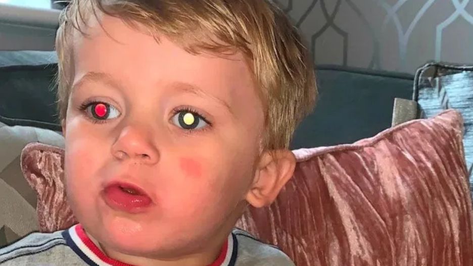 Żółta plama na zdjęciu może być sygnałem groźnej choroby