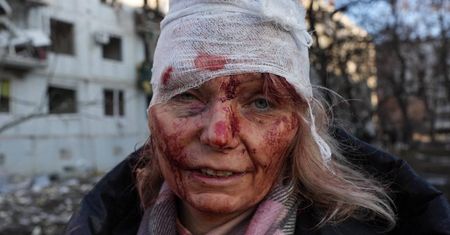 Jej zdjęcie stało się symbolem cierpienia Ukraińców. Teraz wraca do zdrowia w Polsce