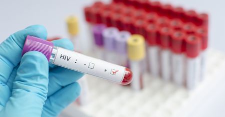 Zmiany klimatu sprzyjają zakażeniom HIV. Zaskakujące ustalenia naukowców