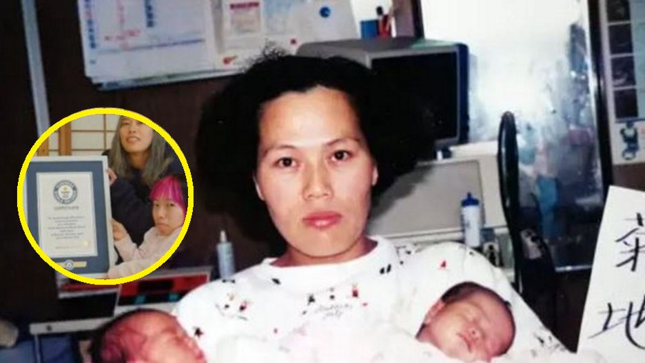 Łączy je wyjątkowa więź, ale dzieli rekordowy wzrost. Bliźniaczki trafiły do Księgi Rekordów Guinnessa