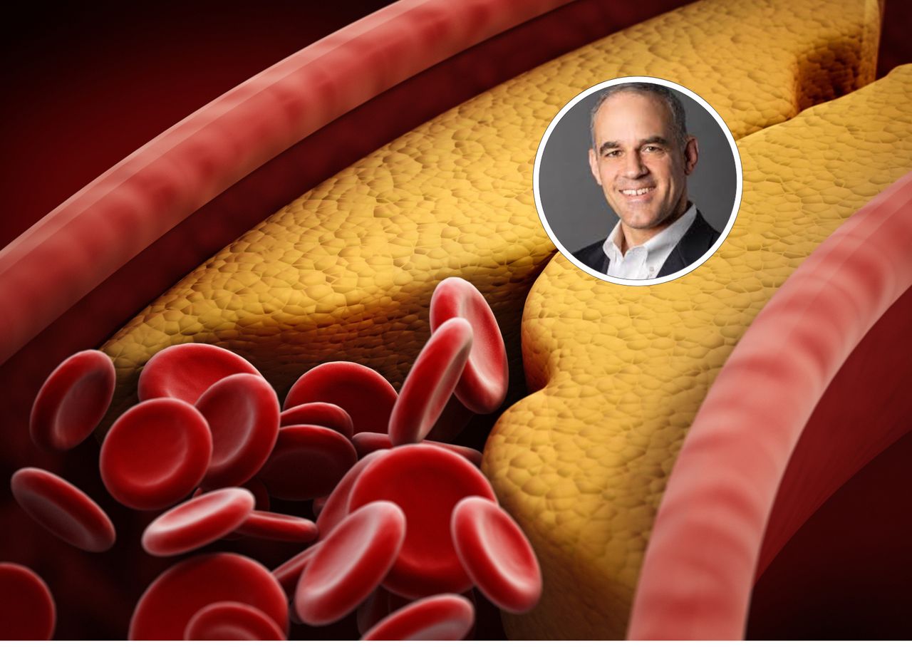 Czyści tętnice. "Cofa blaszkę miażdżycową, zapobiega zawałom"