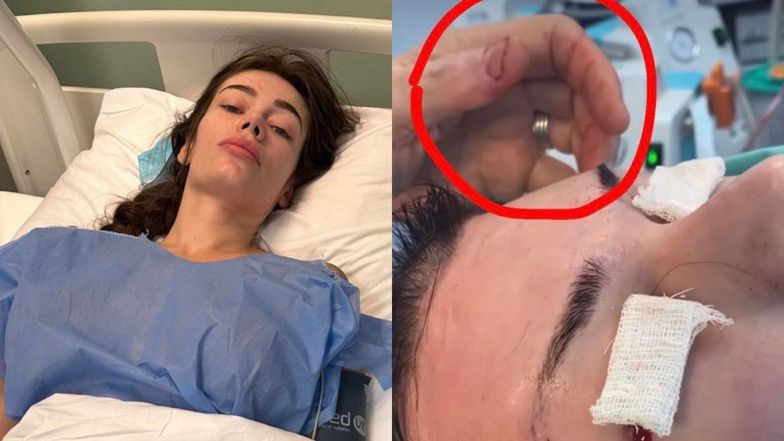 Polka cudem uszła z życiem po operacji w tureckiej klinice