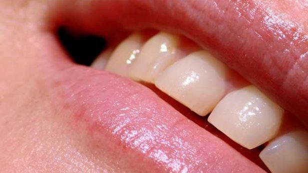 Jeśli stracisz zęba, zastąpi go nowy - drukowany! 1