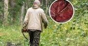Myśliwi zjedli zakażone mięso. Dwóch mężczyzn zmarło na rzadką chorobę