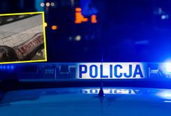 Znęcał się nad psem. Na plecach napisał mu "Putin"