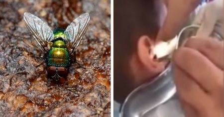 Chłopiec skarżył się na uporczywy ból głowy. Lekarz usunął z jego ucha larwy muchówek [WIDEO]