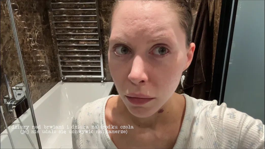 Julia von Stein przed drugim liftingiem