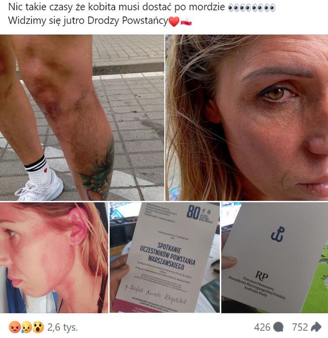 Zofia Klepacka pokazała niepokojące zdjęcia
