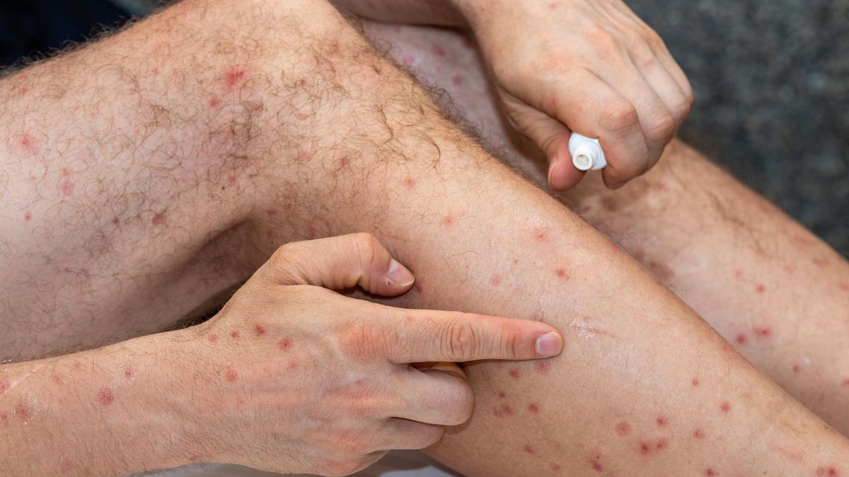 Groźny rak przewodu pokarmowego, którego widać na skórze. Daje jeden objaw