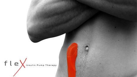 Pompa insulinowa zainspirowana pijawką 1