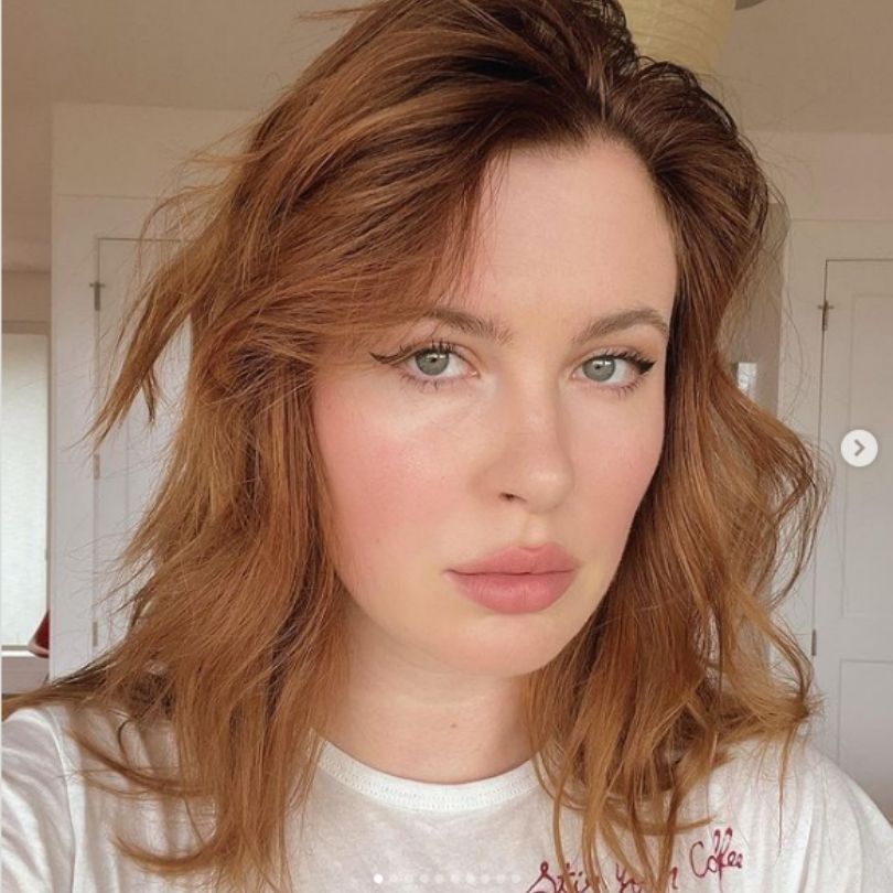 Ireland Baldwin tłumaczy się z zabiegu podbródka