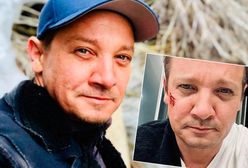 Jeremy Renner miał koszmarny wypadek. Rodzina wydała oświadczenie